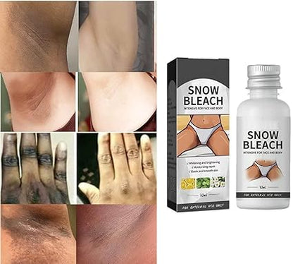 🔥Dark Spot Eraser Cream