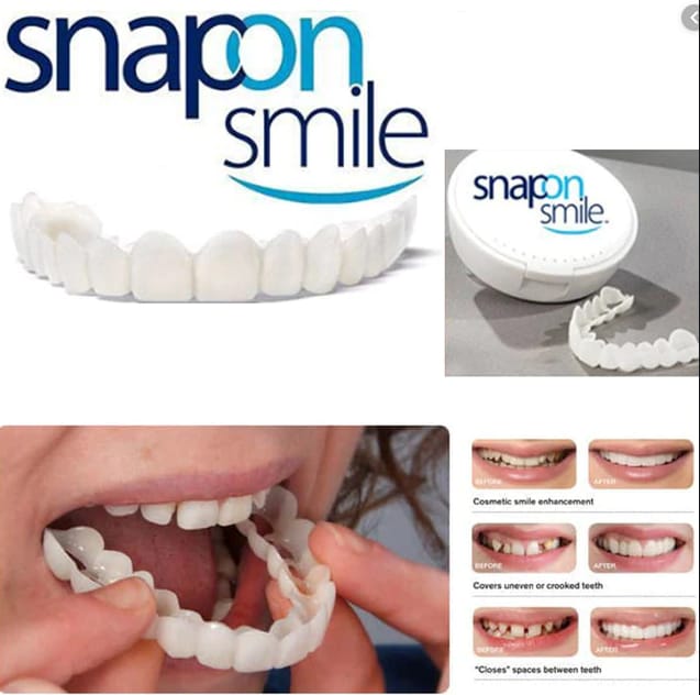 Silicone Imitation Braces – Snap-On Smile Decorative Fake Teeth Kit (Reusable & Safe)