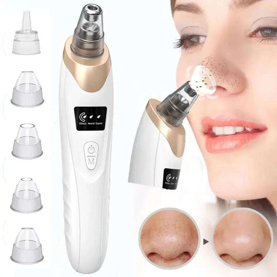 Electric Blackhead Remover Vacuum – Deep Pore Cleaner & Acne Spot Remover